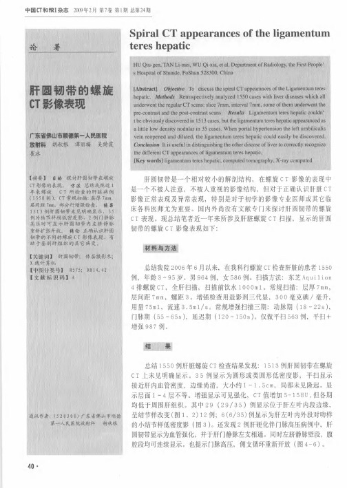 肝圆韧带的螺旋CT影像表现