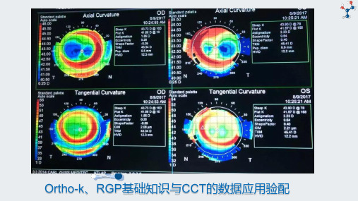 Ortho-k、RGP基础知识与CCT的数据应用验配 聂奇林