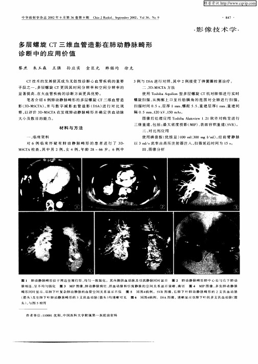 多层螺旋CT三维血管造影在肺动静脉畸形诊断中的应用价值