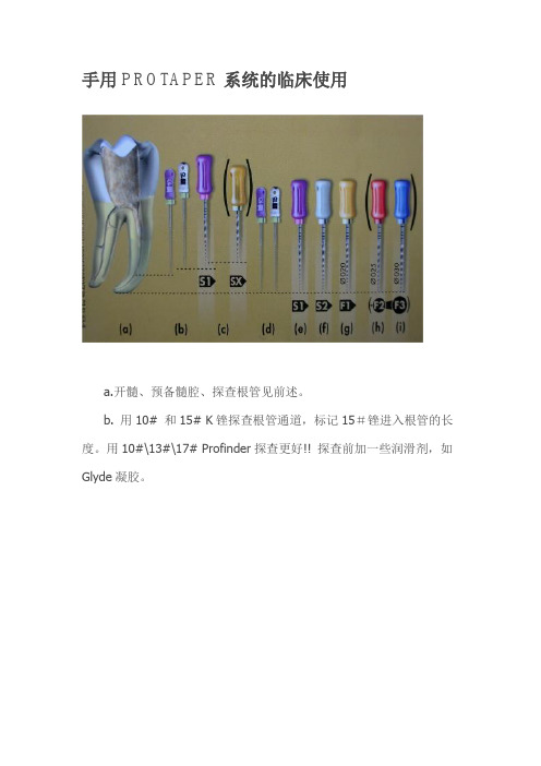 手用PROTAPER系统的临床使用要点