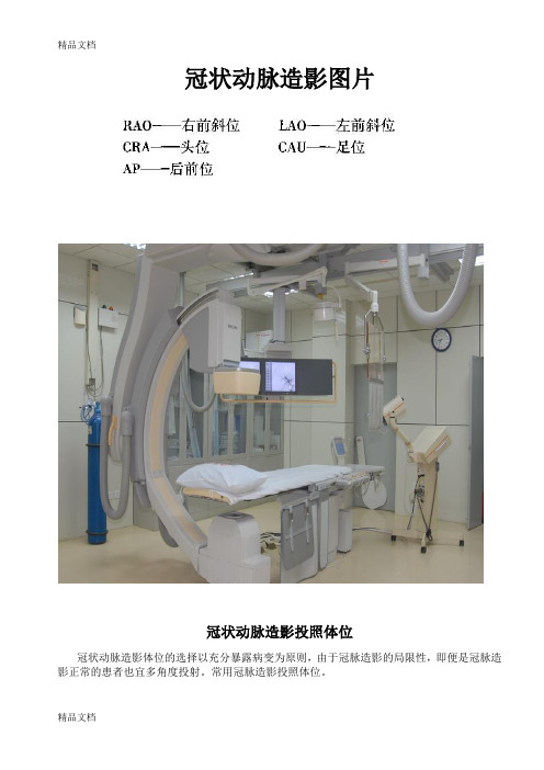 最新冠状动脉造影体位图片