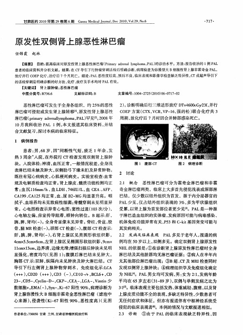 原发性双侧肾上腺恶性淋巴瘤