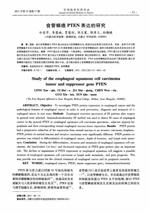 食管鳞癌PTEN表达的研究