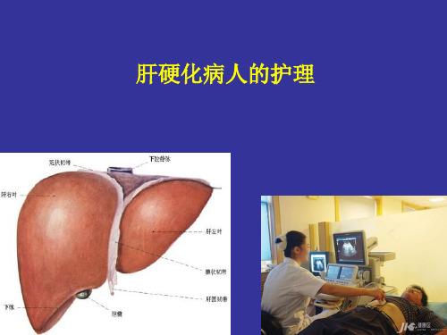 肝硬化病人的护理ppt课件