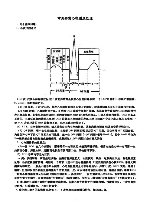 常见异常心电图及处理