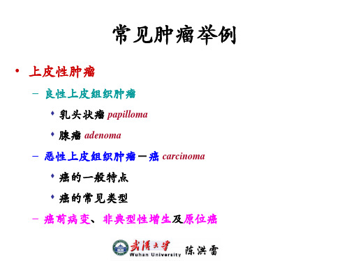 第五章 肿瘤C