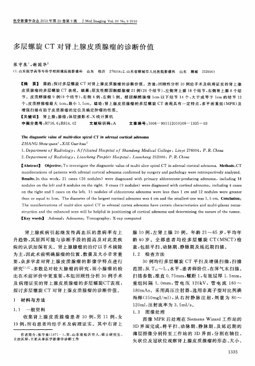 多层螺旋CT对肾上腺皮质腺瘤的诊断价值
