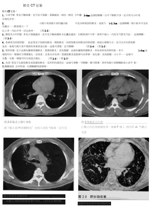 肺炎CT征象资料全