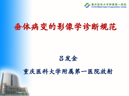 垂体病变的影像学诊断规范