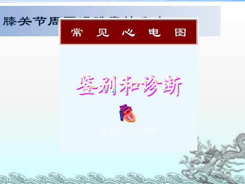 常见心电图鉴别和诊断
