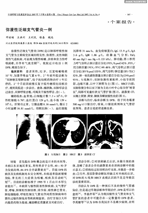 弥漫性泛细支气管炎一例