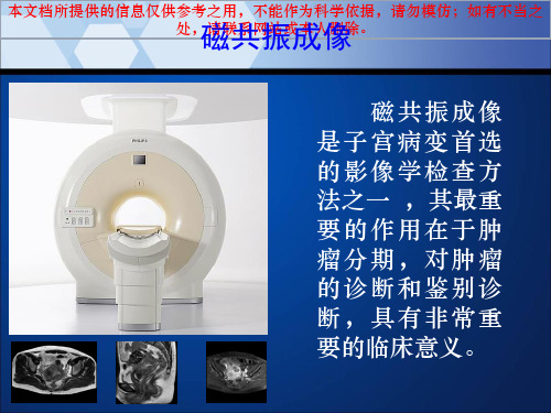 子宫内膜癌MRI影像表现培训课件