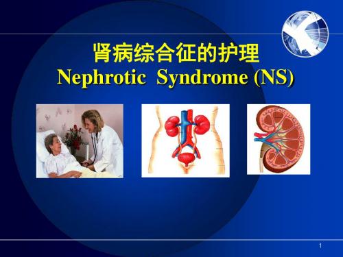肾病综合症的护理ppt课件