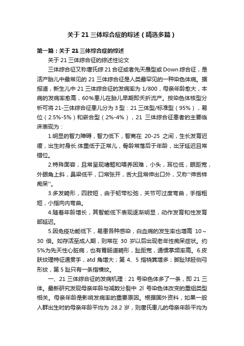 关于21三体综合症的综述（精选多篇）