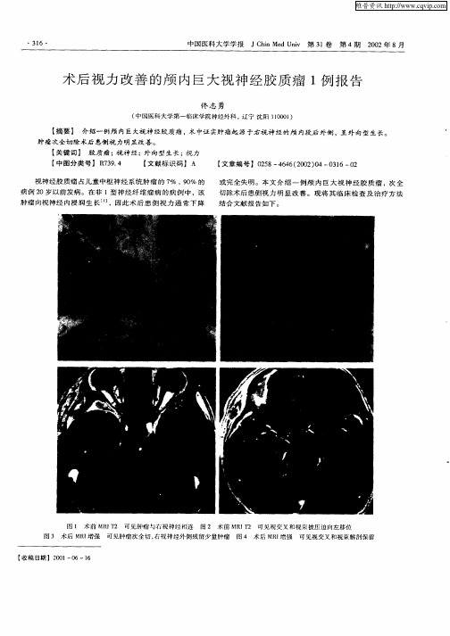 术后视力改善的颅内巨大视神经胶质瘤1例报告