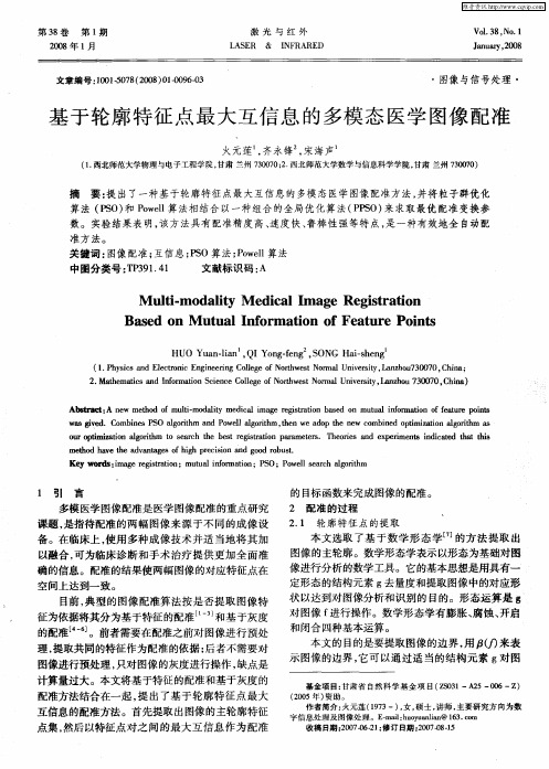 基于轮廓特征点最大互信息的多模态医学图像配准