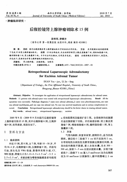后腹腔镜肾上腺肿瘤切除术15例