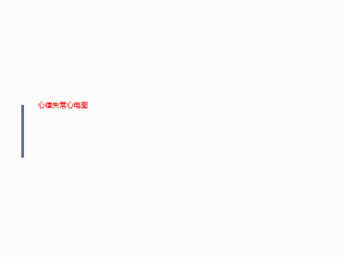 心律失常心电图