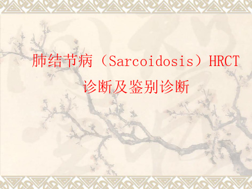 结节病HRCT诊断及鉴别诊断