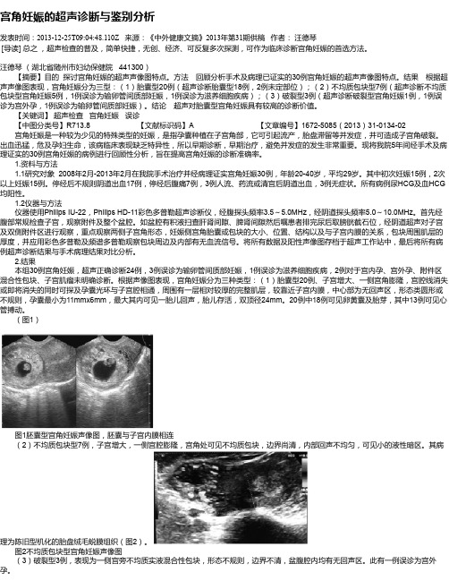 宫角妊娠的超声诊断与鉴别分析