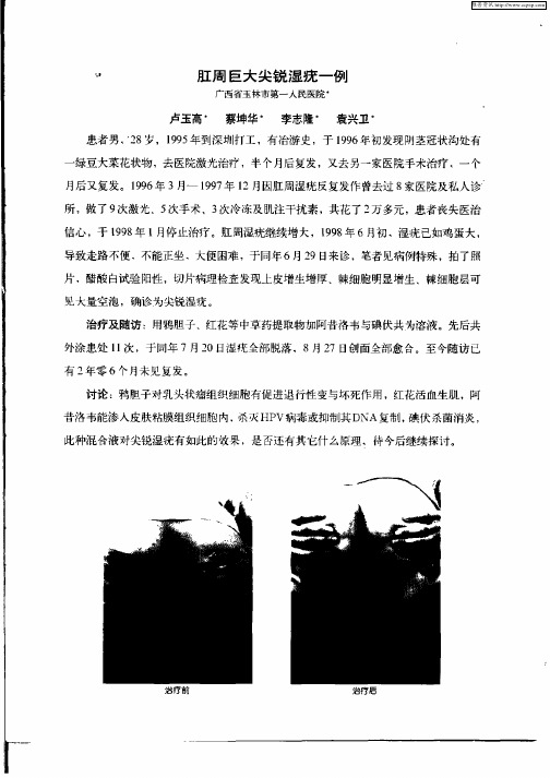 肛周巨大尖锐湿疣一例