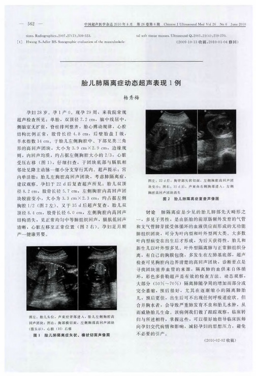 胎儿肺隔离症动态超声表现1例