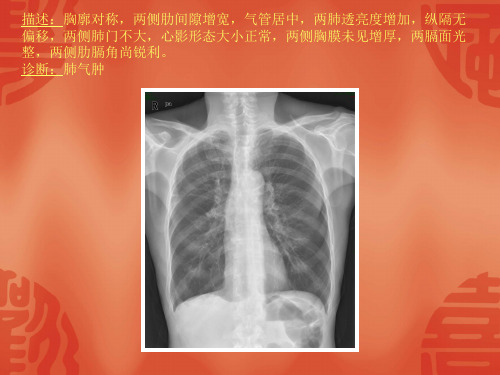 常见40张X片读片及诊断