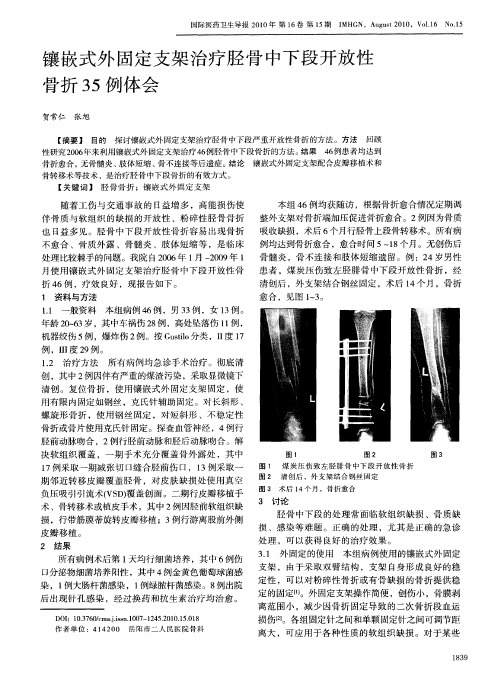 镶嵌式外固定支架治疗胫骨中下段开放性骨折35例体会