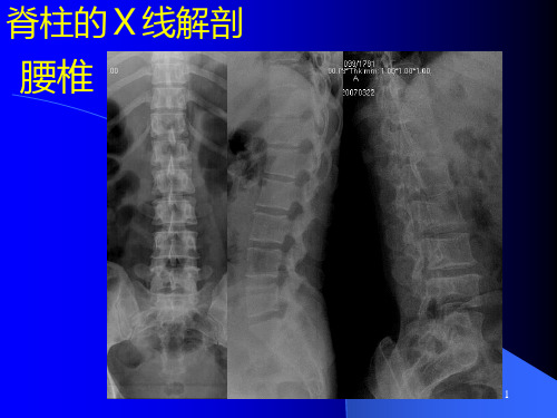 腰椎影像解剖学ppt课件