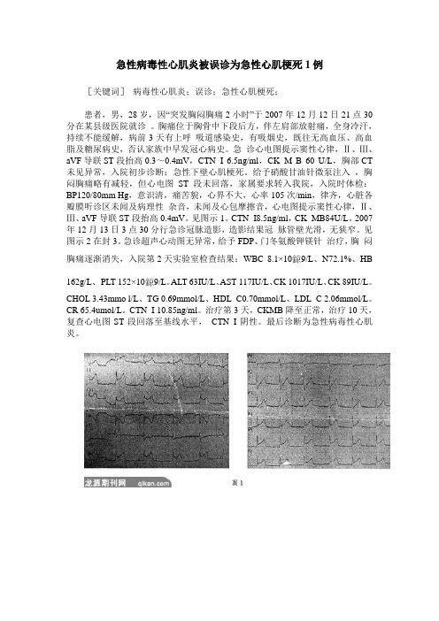 急性病毒性心肌炎被误诊为急性心肌梗死1例