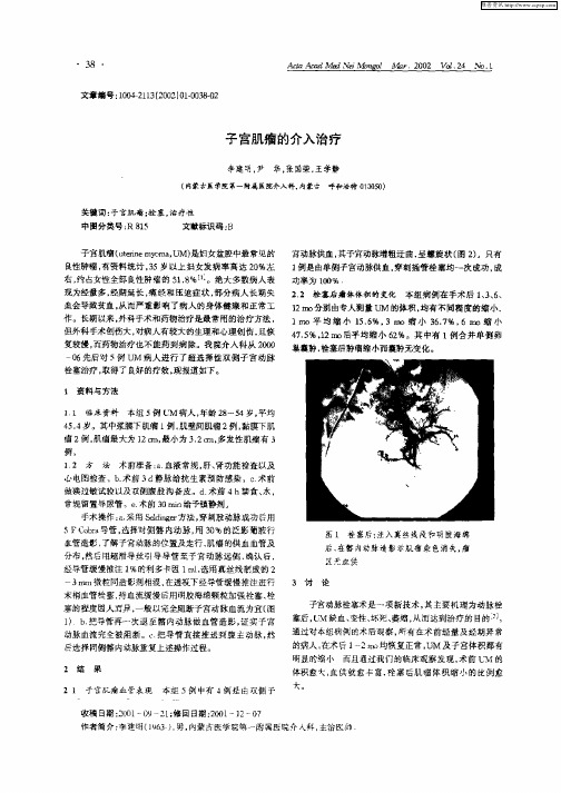 子宫肌瘤的介入治疗