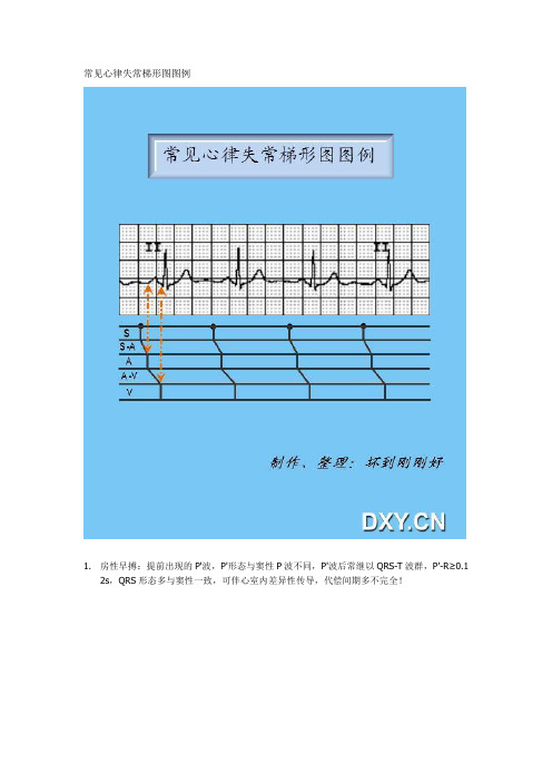常见心律失常梯形图图例