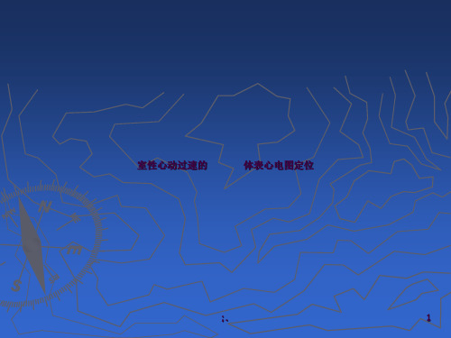 室性心动过速的体表心电图定位_ppt课件