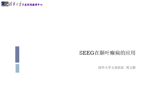 SEEG在颞叶癫痫的应用  周文静