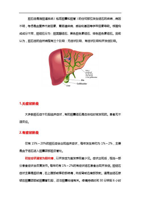 胆石症不同阶段及其临床表现
