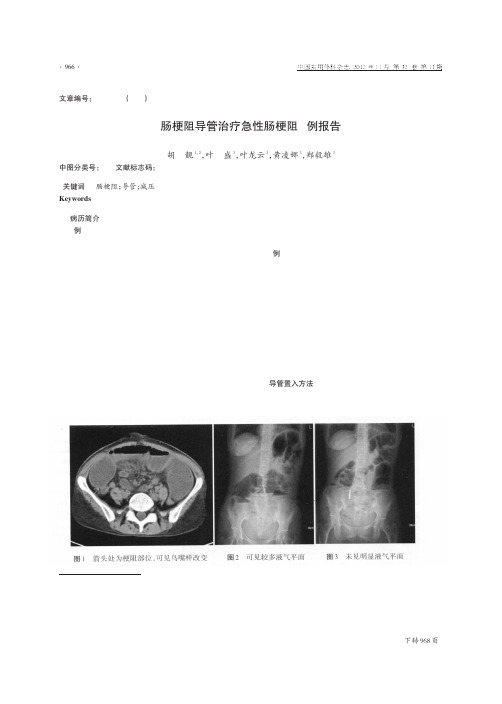 肠梗阻导管治疗急性肠梗阻2例报告