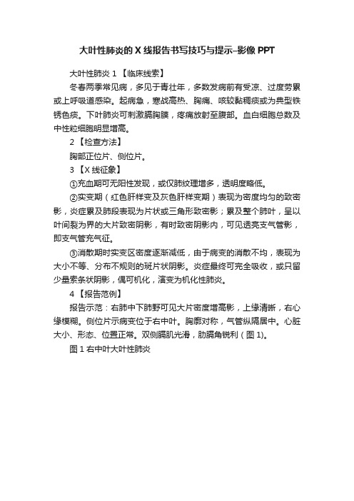 大叶性肺炎的X线报告书写技巧与提示–影像PPT
