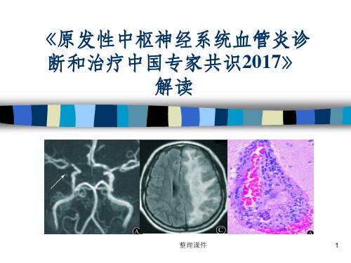 原发性中枢神经系统血管炎诊断和治疗中国专家共识解读