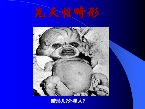 先天性唇面裂和腭裂