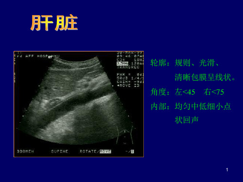 B超影像图谱PPT精选课件