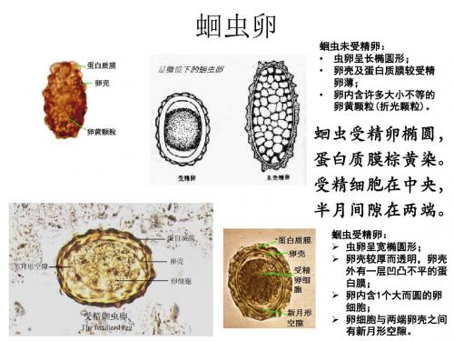 寄生虫学虫卵经典总结及图片-(yj)