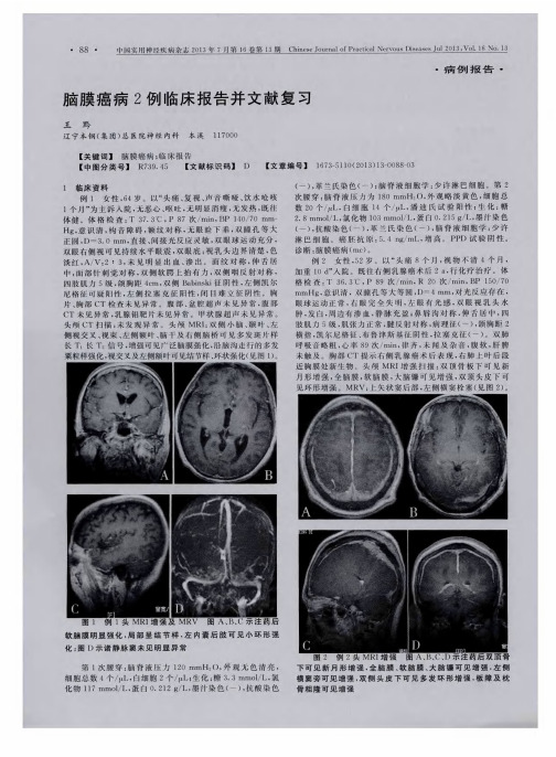 脑膜癌病2例临床报告并文献复习