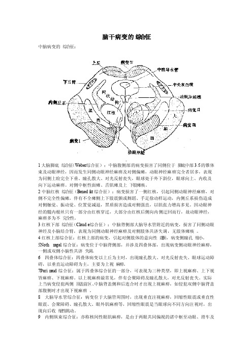 脑干病变的综合征