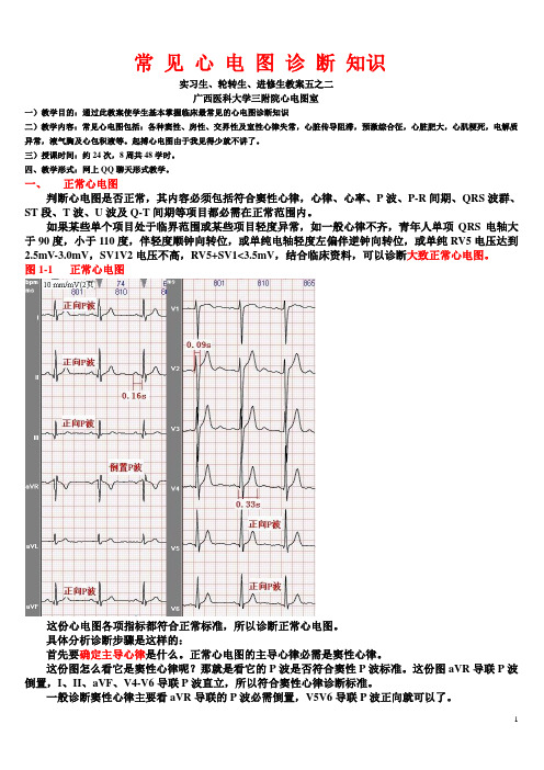 另类心电图讲义-1---正常心电图、心律失常诊断有关概念-2