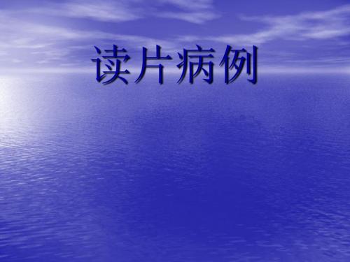 三叉神经鞘瘤ppt课件