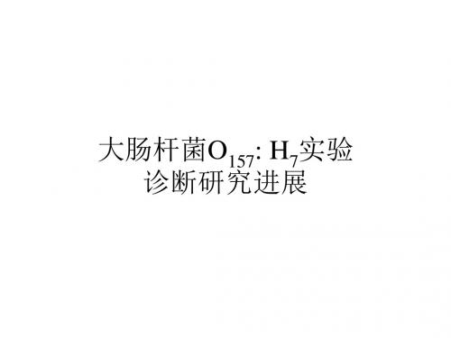 大肠杆菌O157 H7实验诊断研究进展
