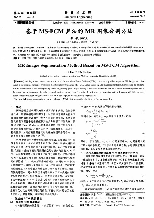 基于MS-FCM算法的MR图像分割方法