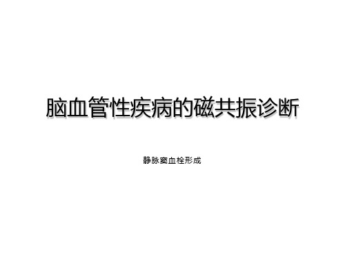 静脉窦血栓形成.ppt
