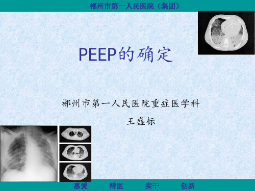 PEEP的滴定