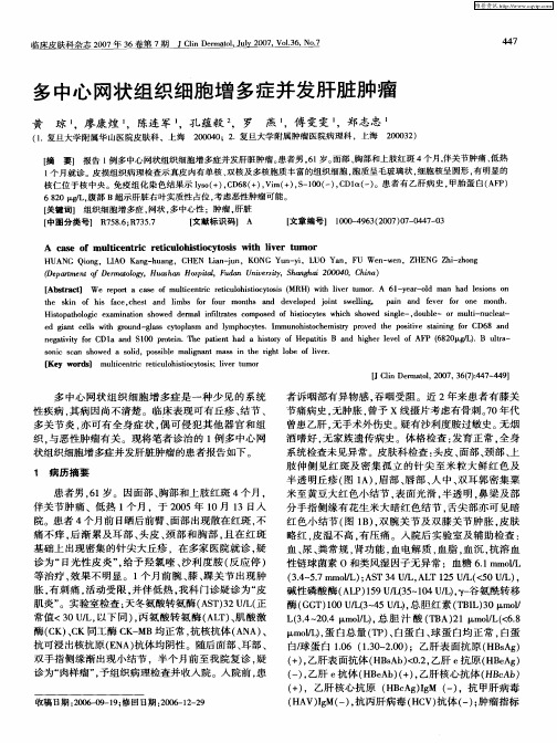 多中心网状组织细胞增多症并发肝脏肿瘤